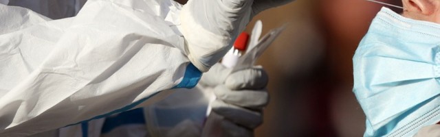 PCR test najskuplji u Srbiji