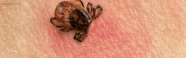 SUPER TRIK SA ČARAPAMA - KAKO DA POTAMANITE 20 KRPELJA ZA 10 SEKUNDI: Ne može biti jednostavnije, a izuzetno je efikasno i provereno "radi" (FOTO)