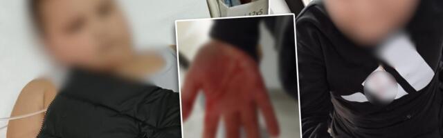Od batina počeo da povraća i krvari: Učenik brutalno pretučen u Vlasotincu (FOTO)