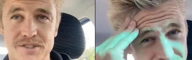 Čovek koji nije prao kosu šest godina tvrdi da se na ovaj način spasio ćelavosti