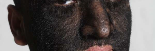 ČOVEK VUK - Najdlakaviji čovek na svetu