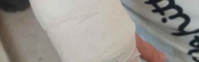 PSI LUTALICE IZUJEDALI DJEVOJČICU U NOVOM PAZARU: Ima ozbiljne povrede po rukama, nogama i glavi