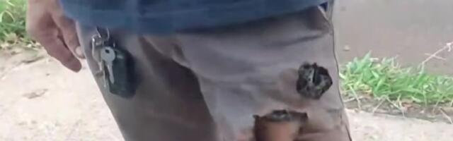 DRAMA USRED DANA! Čoveka napala dva agresivna psa, a onda mu je EKSPLOZIJA u bermudama spasila život