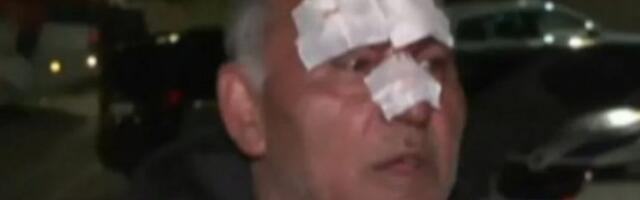 "SVE ME BOLI, ŠUTIRALI SU ME NOGAMA, KRV MI JE NA USTA IŠLA"! Blokaderi prebili nedužnog čoveka u Knjaževcu - VRAĆAO SE NESREĆNIK IZ PRODAVNICE!