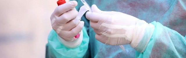 Na Kosovu još devet umrlih i 486 zaraženih