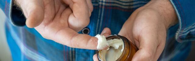 Internet trend ili opasna zabluda: Goveđi loj u ishrani i kozmetici može pogoršati zdravlje