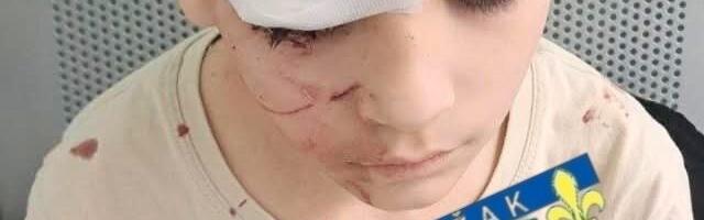 Umalo tragedija: psi lutalice napali dete u Rožajama