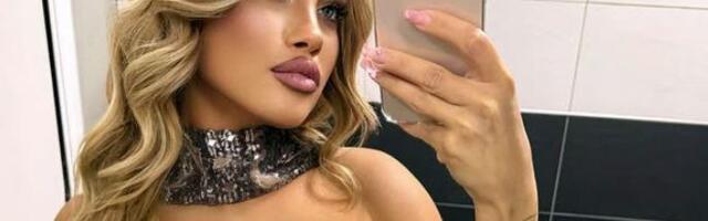 OD STRESA JOJ SE KOČILA VILICA, SADA IZGLEDA KAO AVION: Atraktivna plavuša tvrdi da je trpela nasilje od repera, a nakon razvoda procvetala (FOTO)