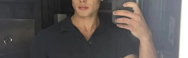 Možda i najbizarniji trend hara društvenim mrežama! Momci sebi lome vilicu, a iza svega stoji OVAJ razlog