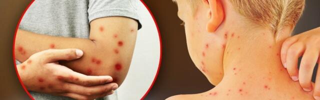 Tragedija u Bangladešu: Većina žrtava malih boginja mlađa od dve godine