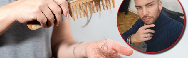 Frizer otkriva rešenje za opadanje kose: Princip koji provereno radi, odmah ga upotrebite