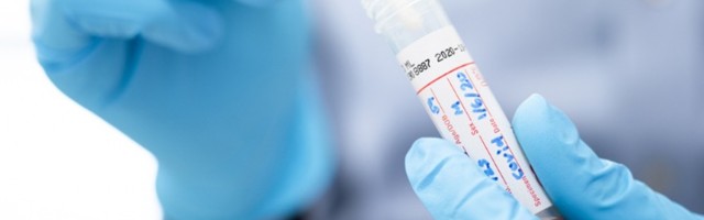 KORONA PRESEK Novozaraženih 1.318, umrlo 18 osoba