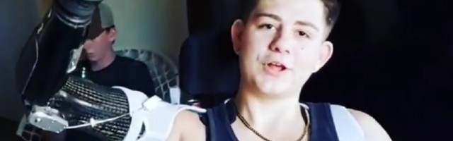 Momku amputirana donja polovina tela: UŽASNA nesreća, ali živ je