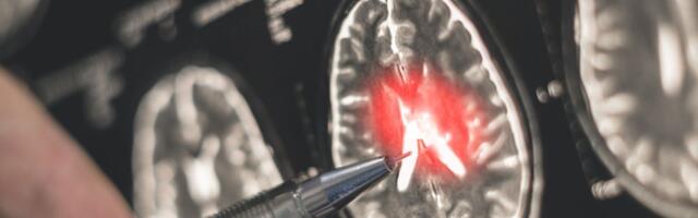 Mladi više ne koriste mozak zbog veštačke inteligencije: Posledice su veoma opasne