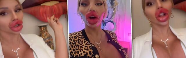 Ima najveće usne na svetu i bebu u naručju: Potrošila 225.000 eura na plastiku - svi je osudili (VIDEO)