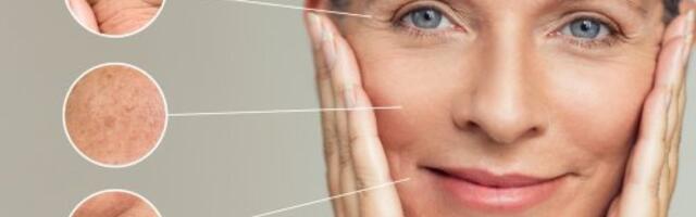 Zbog ovoga bore stižu 10 godina ranije: Jedna navika vam uništava kožu