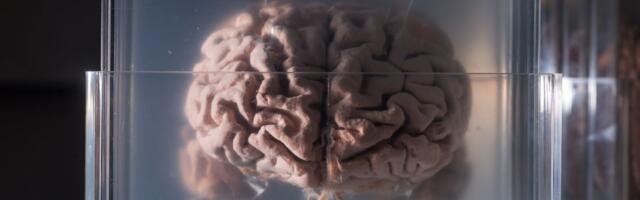 Mozgove preminulih iz Severne Makedonije slali u Ameriku: Šokantno otkriće iz Epstajnovih dosijea