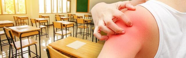 Širi se šuga u blizini Srbije! Prijavljeni prvi slučajevi jezive zaraze - Ovo su simptomi