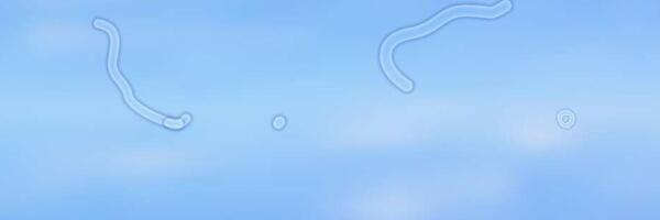 Šta su čudne male stvari koje ponekada plutaju u našem vidnom polju