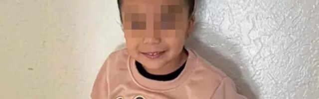 DEVOJČICA (4) PROGUTALA OVAJ OPASAN PREDMET I ZAVRŠILA U KOMI: Progoreo joj rupu tik pored pluća, uništio jednjak! Lekari joj se bore za život (foto)