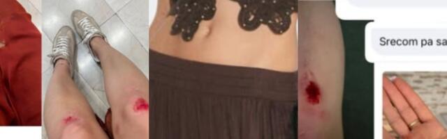 Zarine pantalone “smrti”: Žene prijavljuju padove zbog viralnih širokih pantalona, neke završile na operaciji