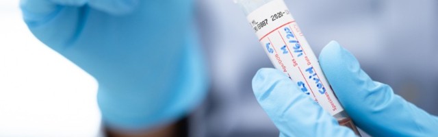 Još 80 novozaraženih, preminulo osam pacijenata