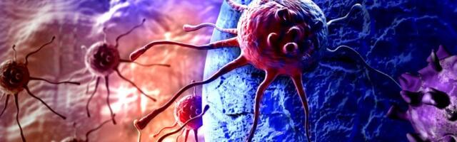 VIŠE MEDICINSKIH SESTARA SA TRUDNIČKOG ODELjENjA DOBILO TUMOR MOZGA: Zaposlena tvrdi na to "nije slučajnost"