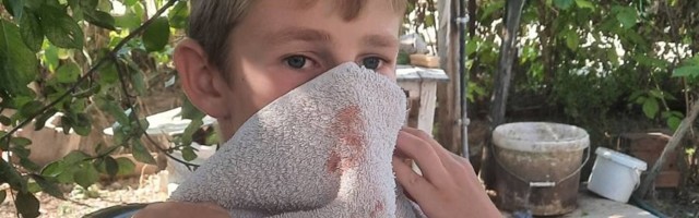 Opet pretučen srpski dečak na KiM, snage KBS-a ušle u srpske sredine „da podele maske“