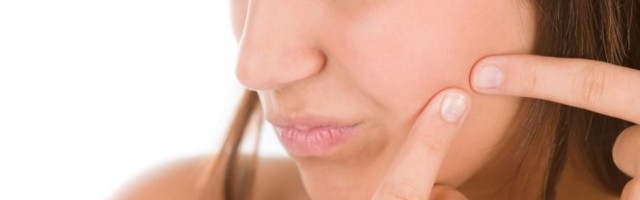 OVE NAMIRNICE MOGU DA IZAZOVU PROBLEME SA AKNAMA! Povedite računa o ishrani!