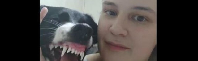 STRAVIČAN INCIDENT: Htela je da poljubi psa pred kamerom, on joj ISKIDAO LICE! (VIDEO)
