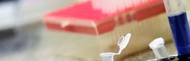 KOVID-19: KRALJEVO 40, SRBIJA 1.817