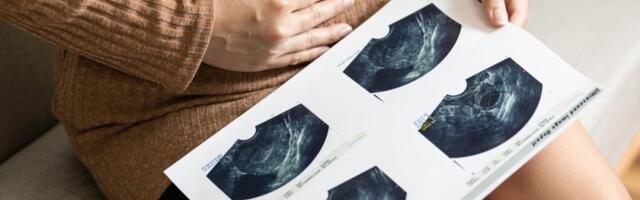 Na hiljade Srba godišnje oboli: Ovo je jedan od najčešćih karcinoma - Simptomi su neprimetni