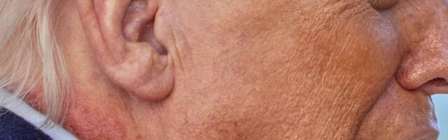 (FOTO) Šta se ovo dešava sa Trampom?! Odjeknulo ozbiljno pitanje o zdravlju vrhovnog komandanta SAD