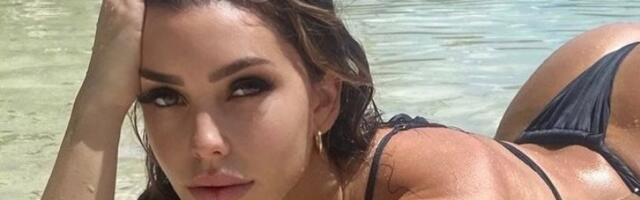 Grudi veličine lubenice, a zadnjica ubrzava puls: Brushalter nikad ne nosi - muškarci na aparatima (FOTO)