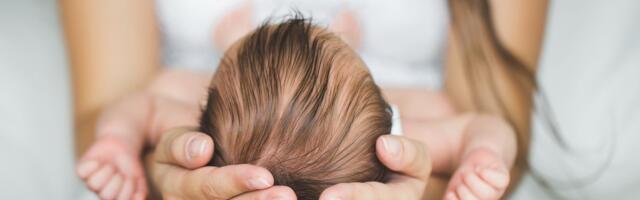 Beba se rodila sa "balonom" na čelu i jedva preživela! Majka Hana poručila:"Nesavršeno je savršen i moje čudo"