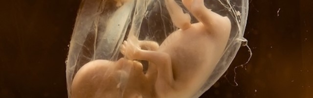 Čovekov nerođeni blizanac oteo mu je sina zahvaljujući genetskom kimerizmu!