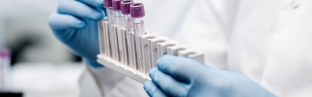 U Hrvatskoj 2.769 novoobolelih, umrlo 15 osoba