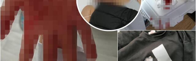 (VIDEO) UZNEMIRUJUĆE! JEZIVO VRŠNJAČKO NASILJE U VLASOTINCU! Dečaka zlostavljala unuka direktorke škole, oglasila se majka za Kurir: "Krvav i sam je pošao kući"