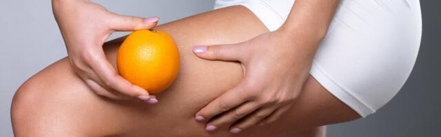 5 činjenica o celulitu: Večita borba sa pomorandžinom korom koja ženama zadaje glavobolje