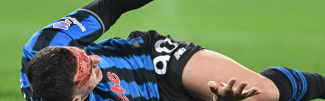 STRAŠNE SCENE! Nikola Krstović objavio sliku iz svlačionice - broje se kopče na glavi posle užasne povrede