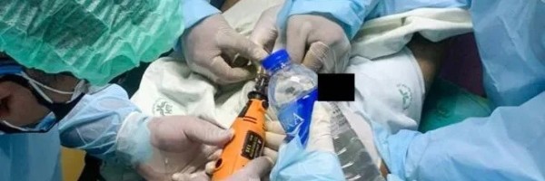 Zakačio katanac na penis pretvorivši ga u plavi patlidžan