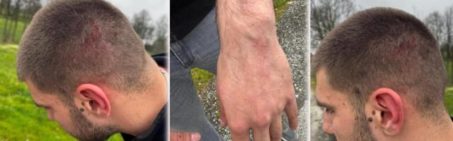 Palice, biber sprej, municija... Privedeni napadači na Vukašina Đokovića - Njih petnaestorica, evo šta su sve imali kod sebe