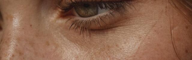 Signali koje ti daje koža ako joj ne odgovara krema koju koristiš