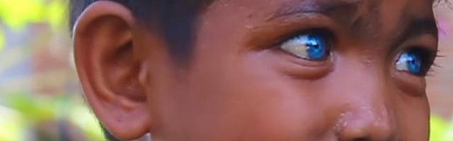 Genetska mutacija i nasledan Vaardenburgov sindrom od ovog plemena je napravio da budu najposebniji ljudi na svetu!  (VIDEO)