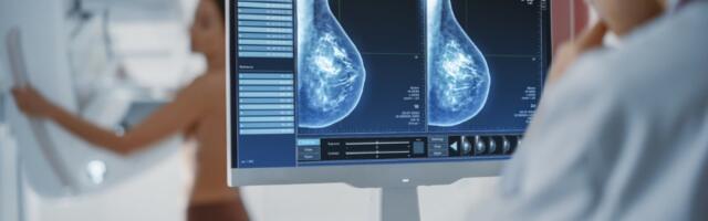 Mobilni mamograf na Kalemegdanu: Besplatni pregledi