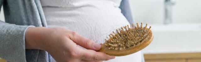 Zašto kosa počinje da opada nakon porođaja