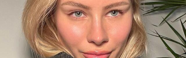 Umesto balzama za usne: Ovo je novi trend za sočne i mekane usne