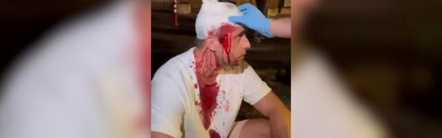 Mitrović: Prebijali su me SNS huligani - tužilaštvo štiti napadače