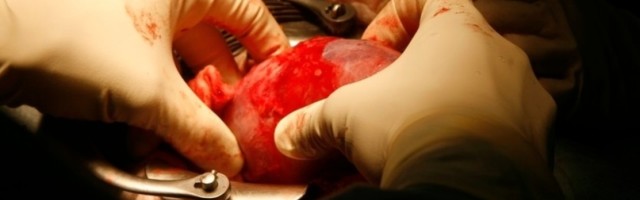 Dečaci su otišli ​​na rad u Meksiko, umesto toga izvađeni su im organi!