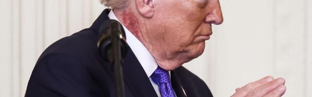 Snimak Donalda Trampa izazvao bes u Beloj kući: "Vi glupi idi**i, poremećeni ste!"